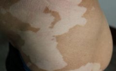 �ڶ��Ͱ��緢��ԭ��