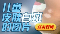 ��ͯ���ϻ��ϰ�������ô����?