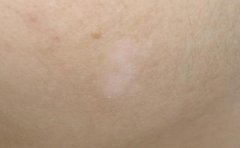 ���������֢״����Щ