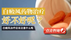 儿童早期白癜风怎么治疗?