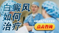儿白癜风的治疗方法有哪些?