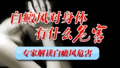 白癜风对患者造成哪些身心危害