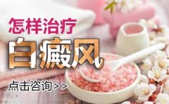 如何选择合适的方法治疗脸部白癜风