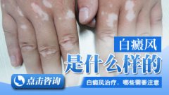 �ΰ��������ĸ��о�ԺƤ�����ȽϺ�