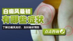 ��������Щ֢״