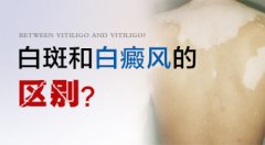 白癜风和白斑的区别