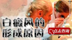 �����γɵ�ԭ������Щ