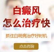 白癜风怎么治疗快?
