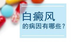 白癜风的病因有哪些呢