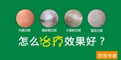 白癜风怎么治疗效果好