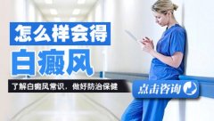 什么原因会得白癜风呢