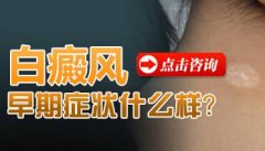 ���ڰ���֢״����������Щ