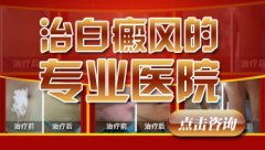 西昌治疗白癜风的专业医院有哪几家