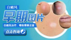 ���ڰ����֢״����Щ��